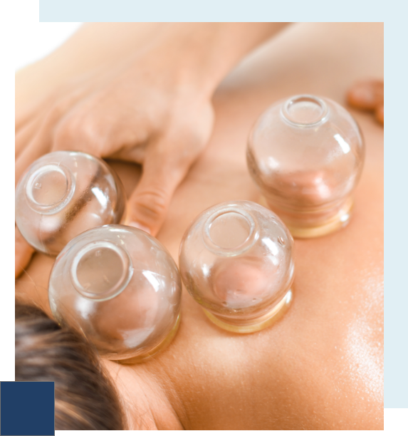 tratamiento cupping - fisioterapia - moraleja caceres